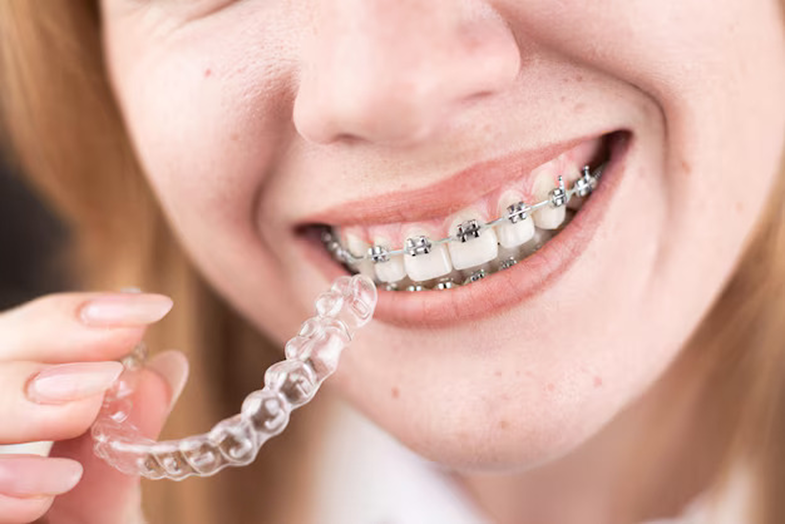 Willeri Dental Parkwood