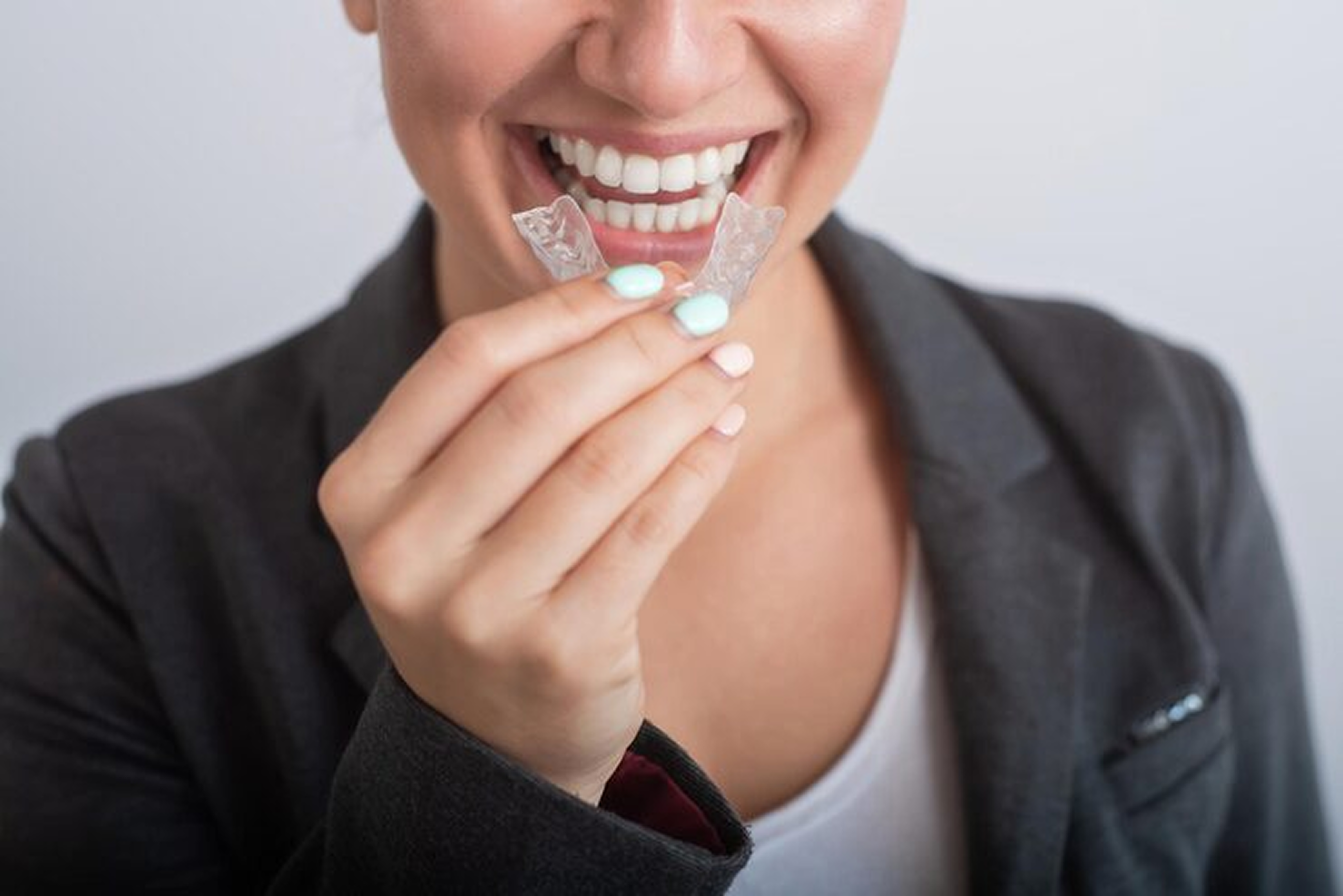 Willeri Dental Parkwood